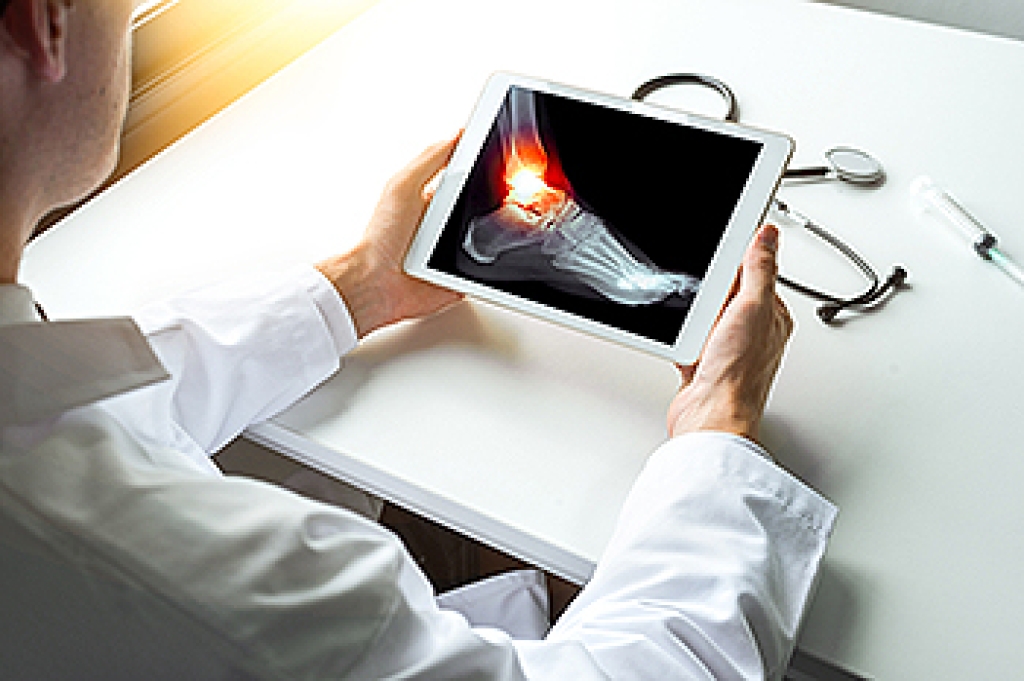 Causes and Recovery of a Broken Ankle