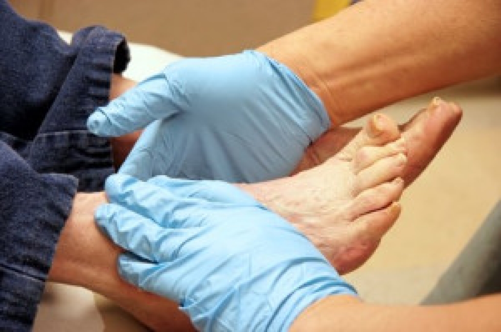 Diabetes and Foot Health